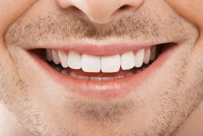 gum disease treatment at Midtown Dental in Lakeland, FL