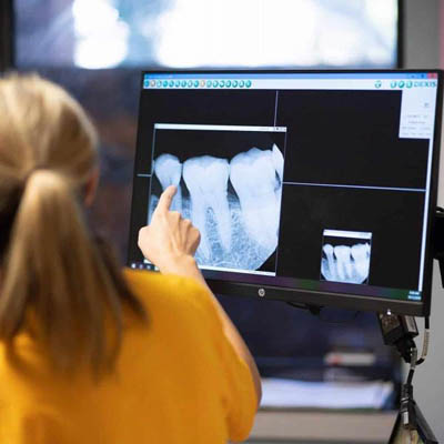 3D digital X-rays used at Midtown Dental